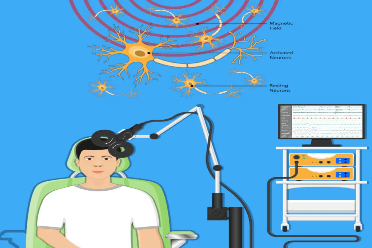 rTMS διαδικασία